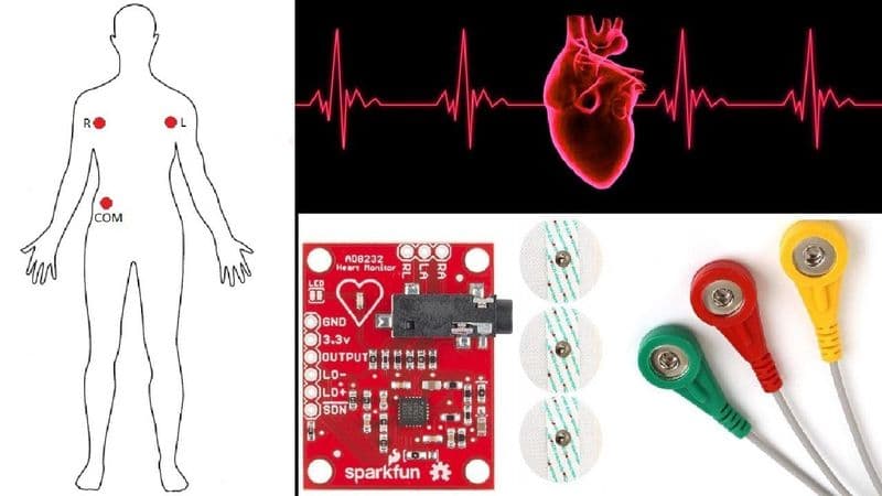 ECG Monitoring system ( Ready made ) - View 1